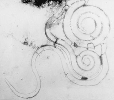 FIG. 11