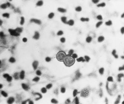 FIG. 22