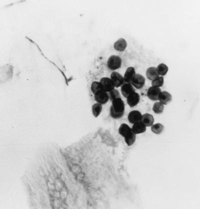 FIG. 15