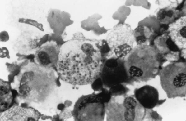 FIG. 23