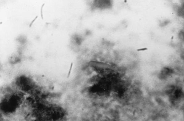 FIG. 13