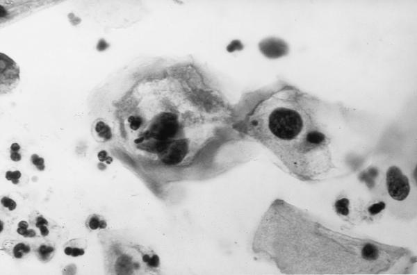 FIG. 35
