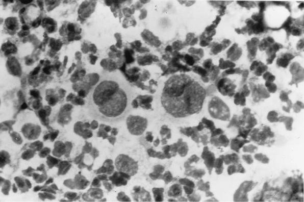 FIG. 32