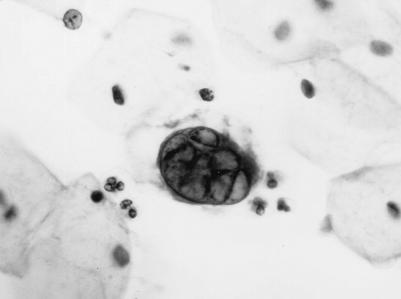 FIG. 30