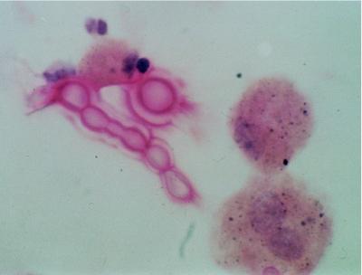 FIG. 21