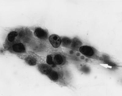 FIG. 14