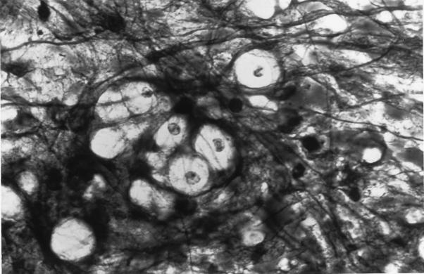 FIG. 19