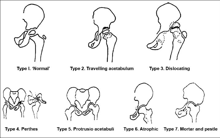 Figure 1A