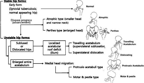 Figure 1B