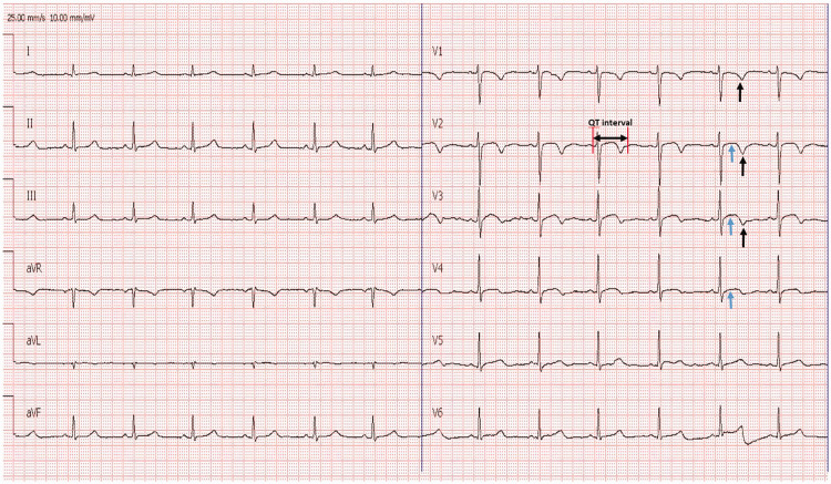 Figure 3.