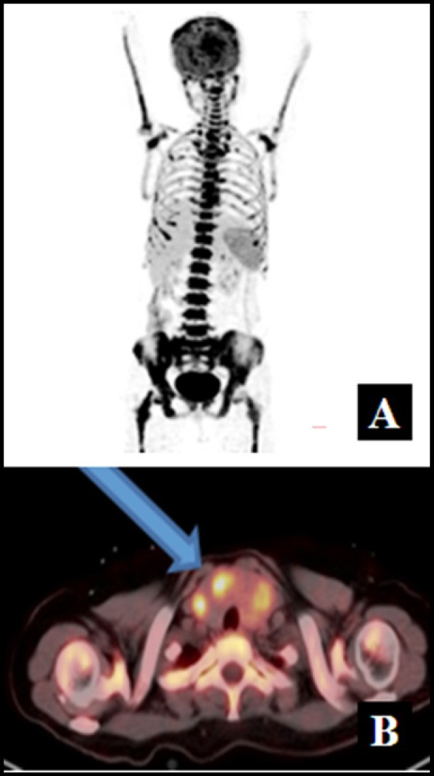 Figure 1A and B