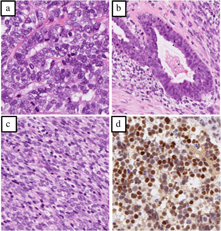 FIGURE 2