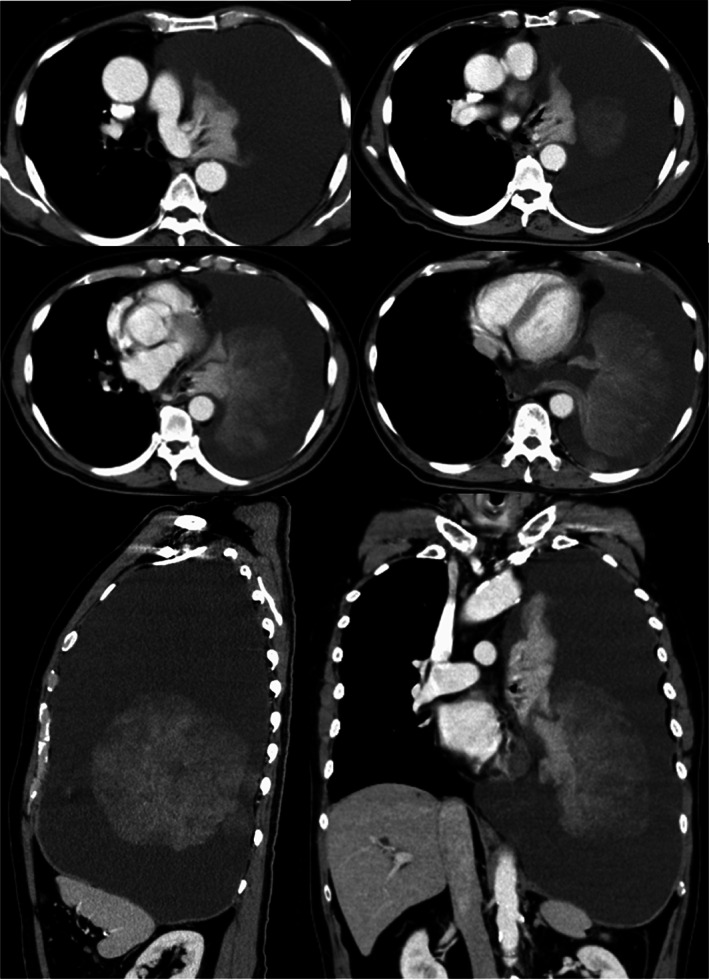 FIGURE 1