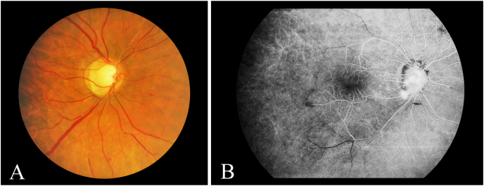 Fig. 5