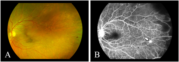 Fig. 4