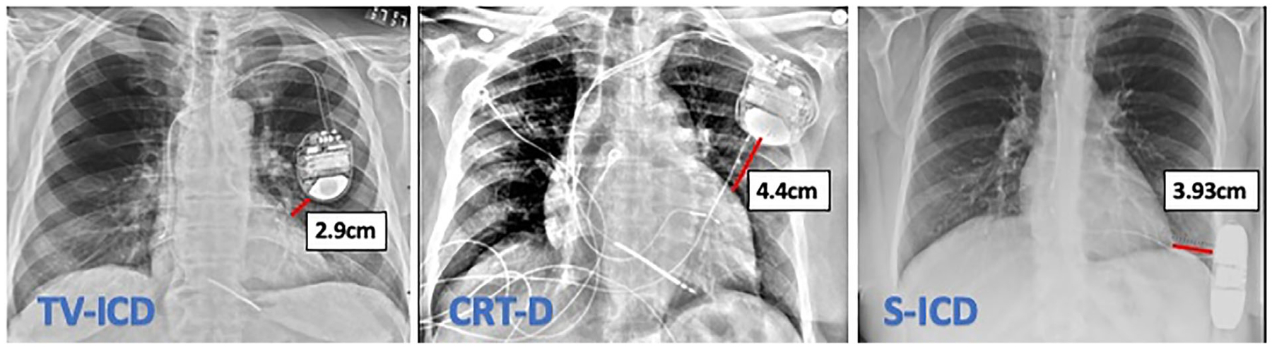 FIGURE 6: