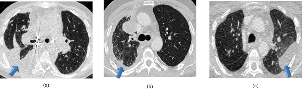 Fig. 11