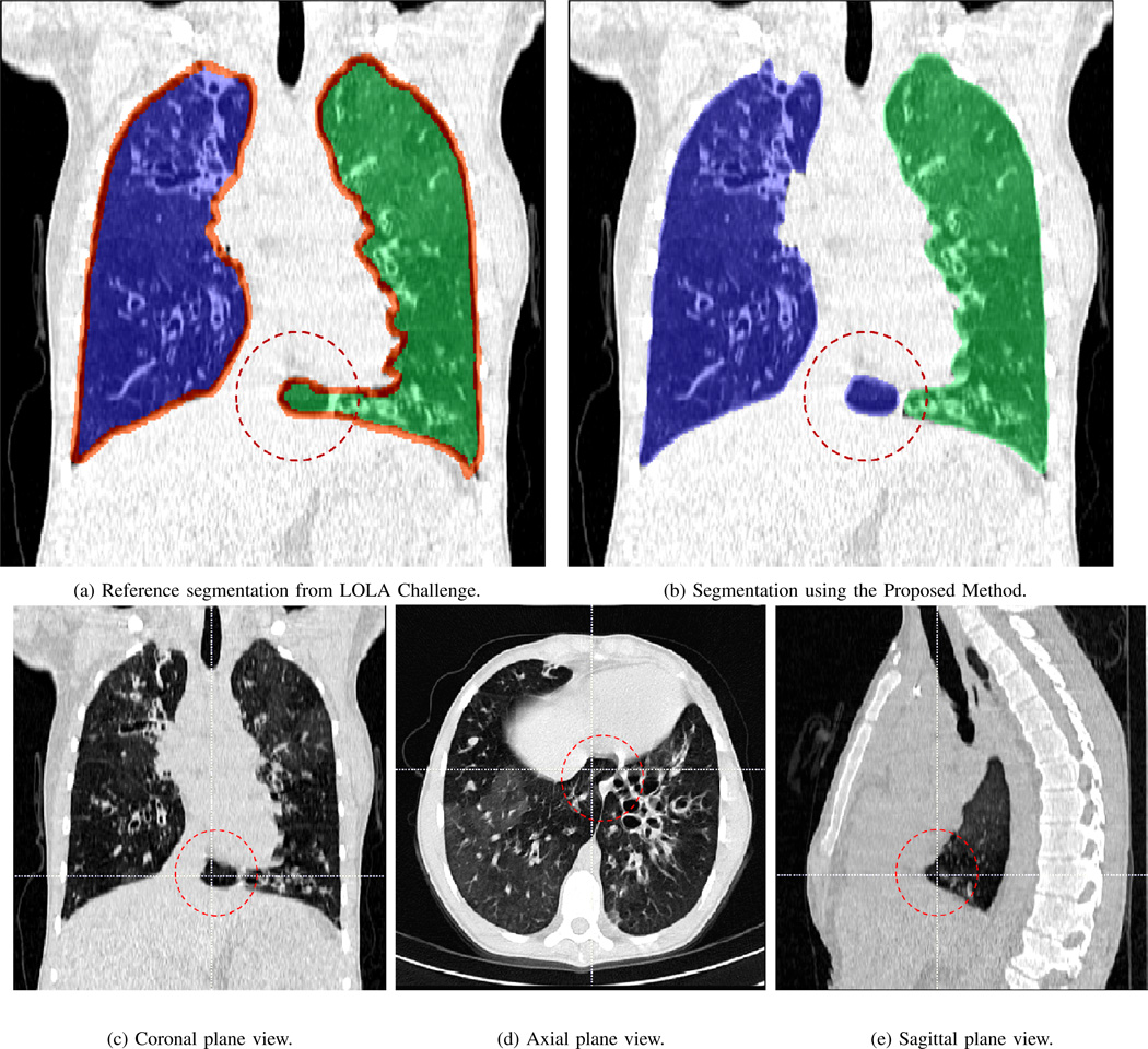 Fig. 19