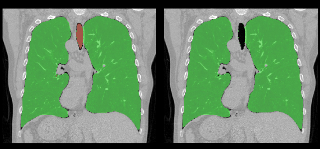 Fig. 13