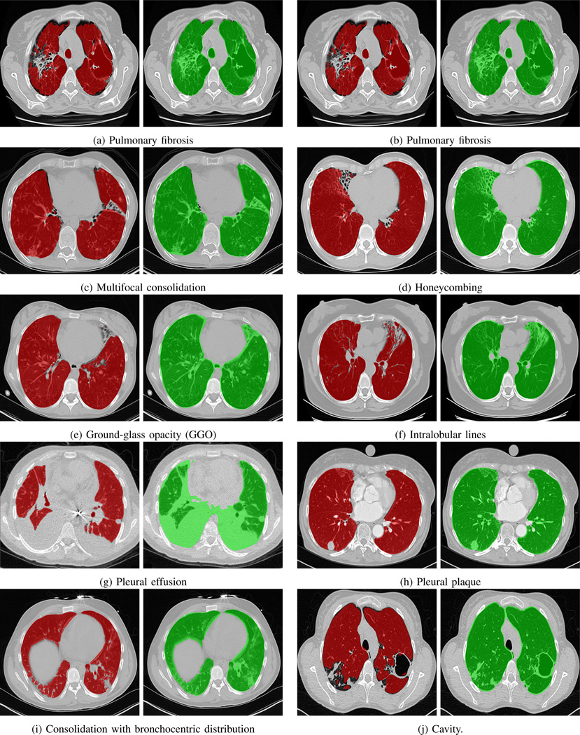 Fig. 16