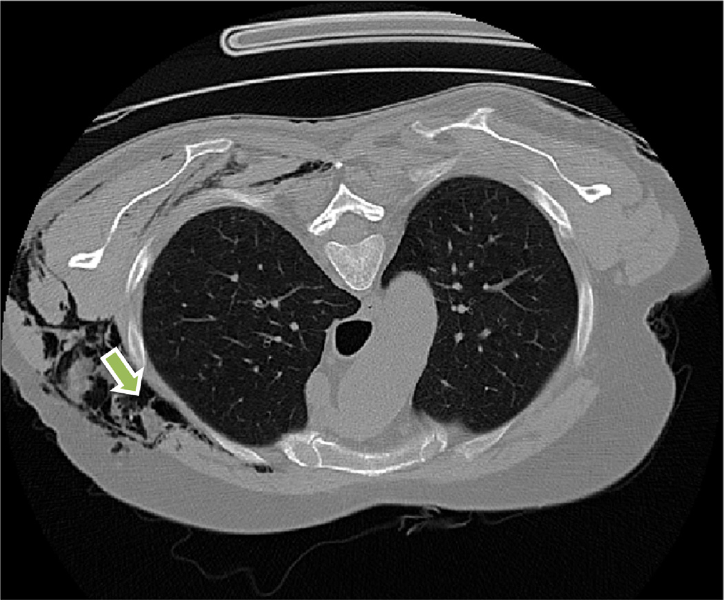 Fig. 22