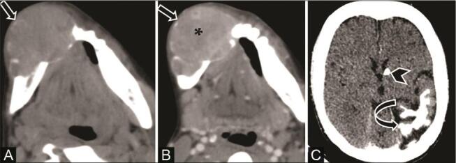 Fig. 21