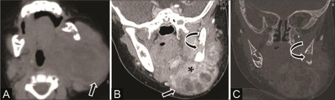 Fig. 19