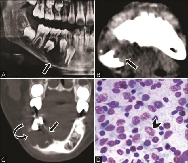 Fig. 10