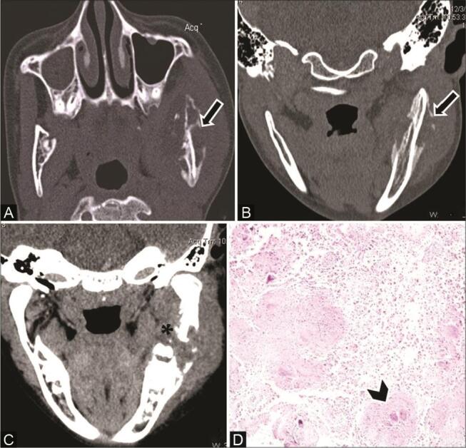 Fig. 17