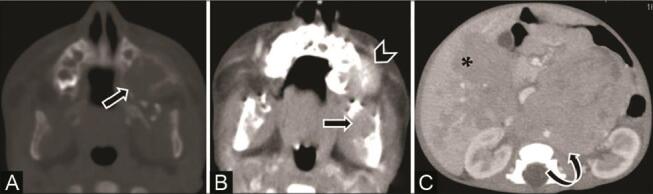 Fig. 18