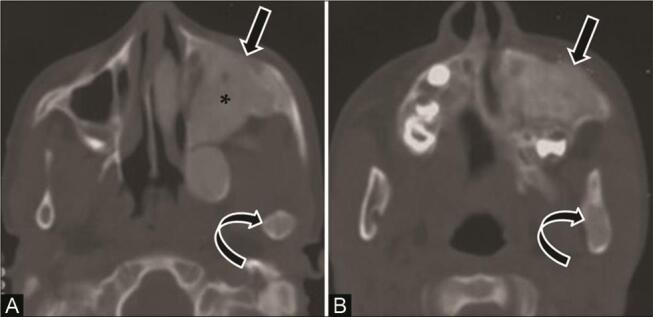 Fig. 14