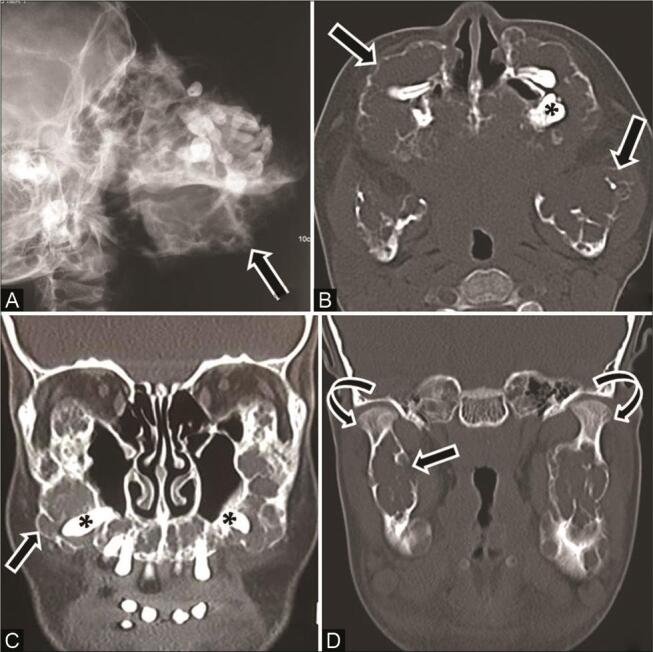 Fig. 15