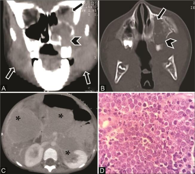 Fig. 12