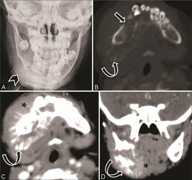 Fig. 11