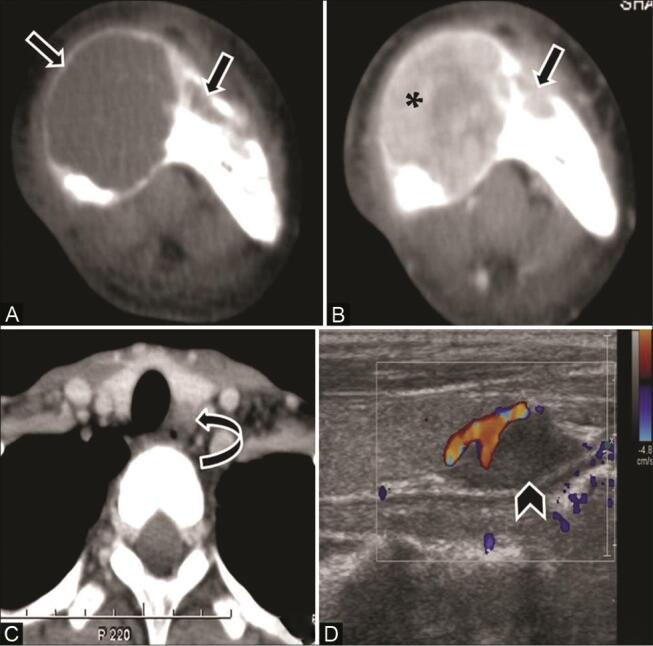 Fig. 20