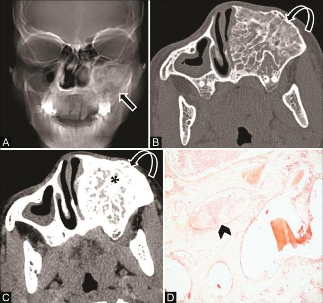 Fig. 16