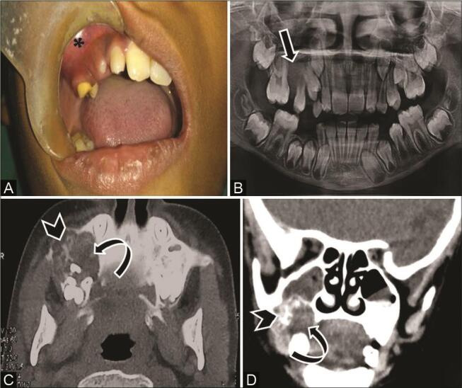 Fig. 13