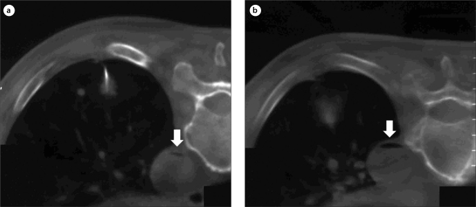 Figure 1. a, b.