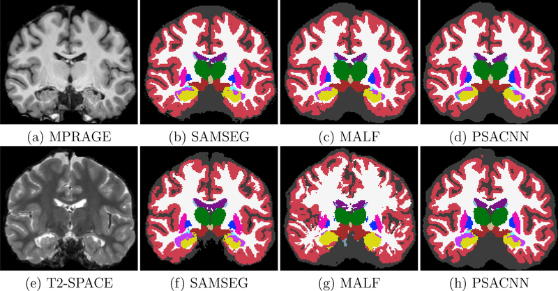 Figure 15: