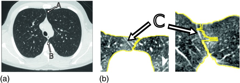 FIG. 1.