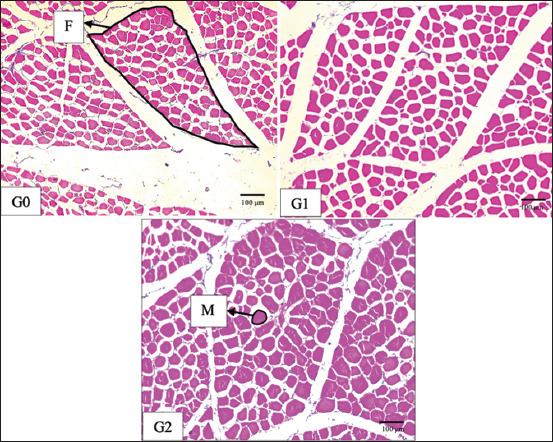 Figure-1