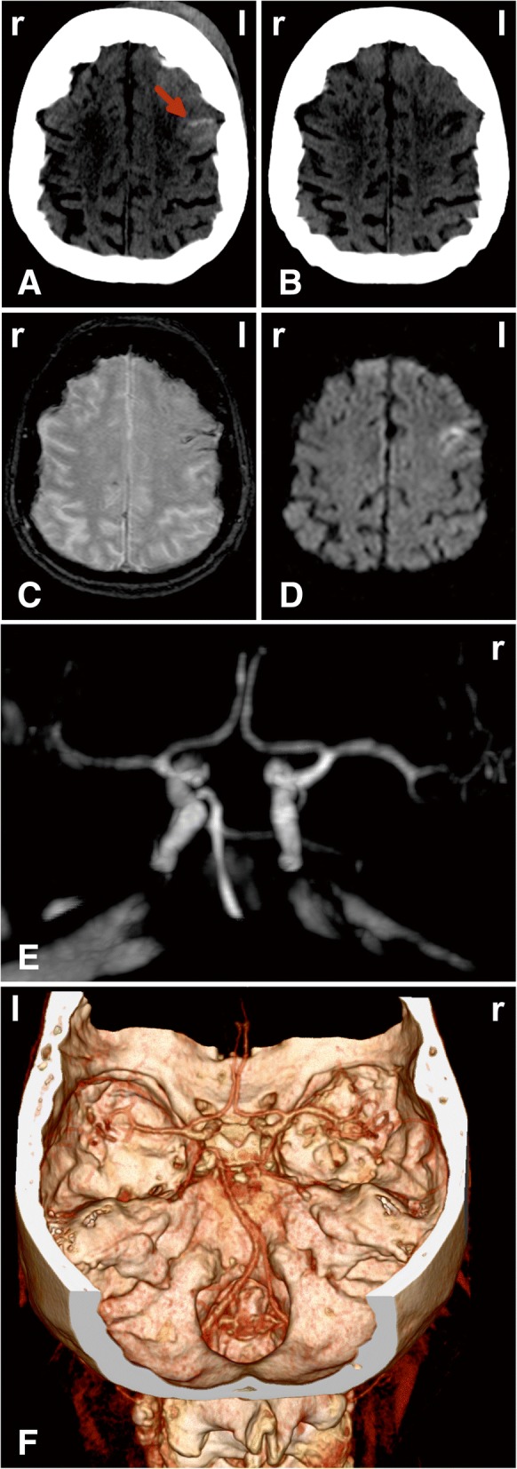 Fig. 1