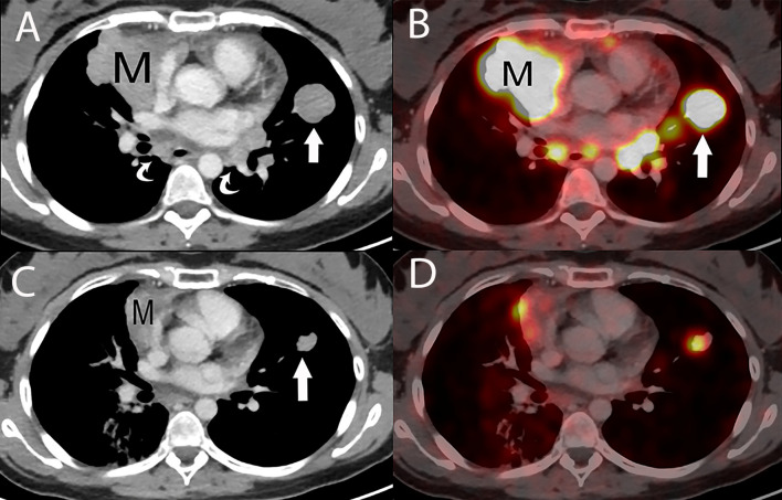 Figure 14