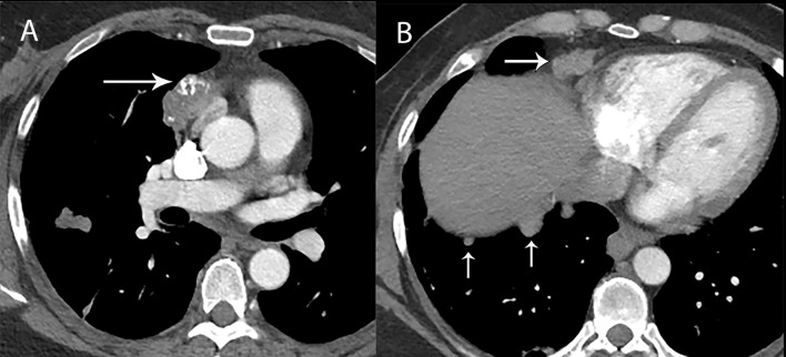 Figure 13