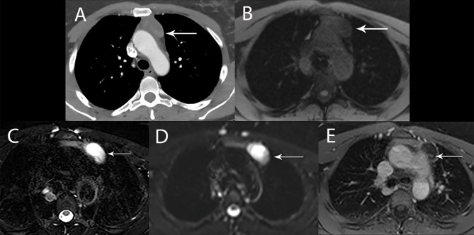 Figure 5