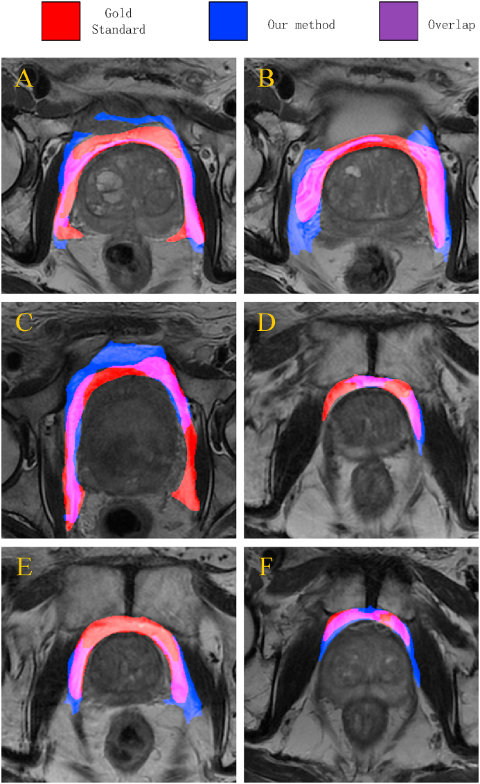 Fig. 9