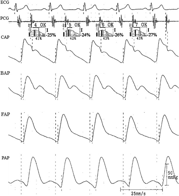 Fig. 1