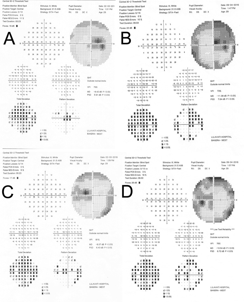 Fig 3