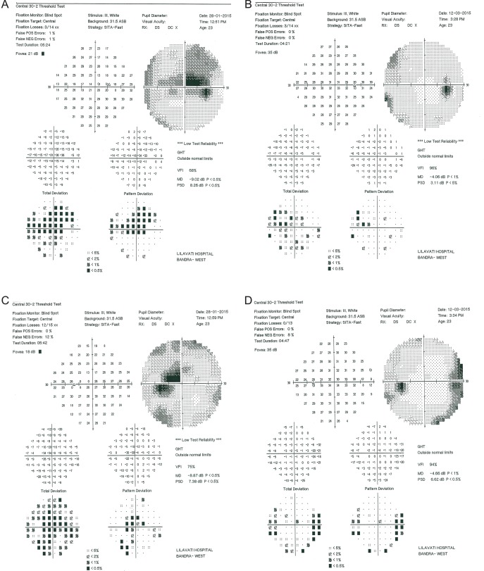 Fig 2