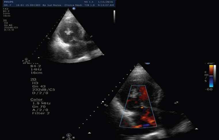 Fig. 2